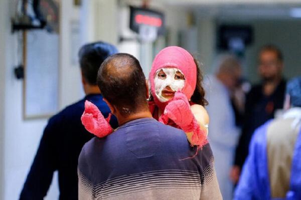 آمار ترسناک فوتی ها و مصدومان چهارشنبه سوری ، تا الان 5 استان در صدر حوادث